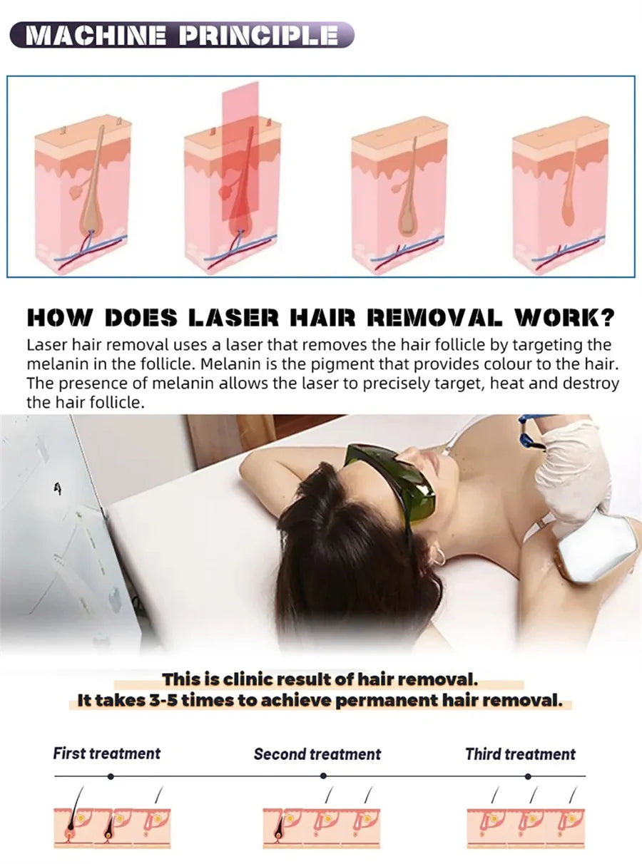 Professional Diode Ice Titanium Laser Hair Removal Machine Portable