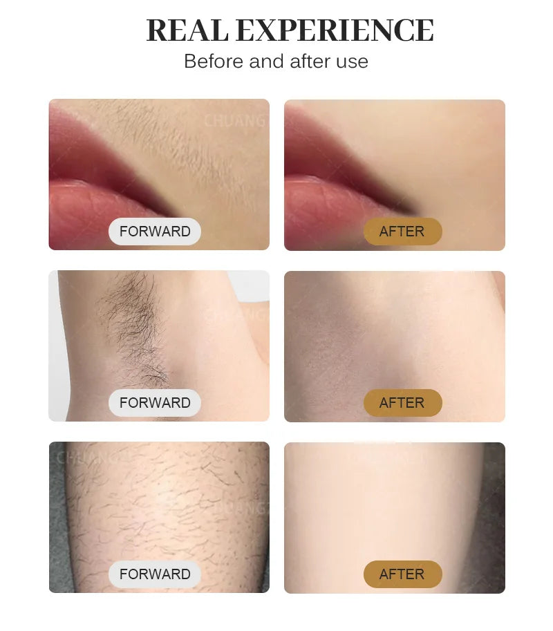 Professional Diode Ice Titanium Laser Hair Removal Machine Portable